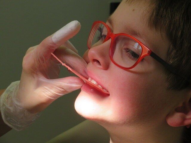 Kinder Zahnzusatzversicherung Zahnspange